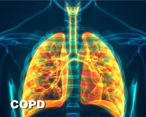 Lungs & COPD